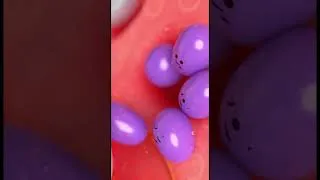 Thumbnail: Your Scalp Has Been Trying To Warn You