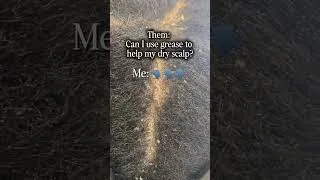 Thumbnail: One of the most common questions I hear is, 'Can I grease my scalp?' The answer depends on what's ac