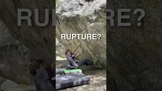 Thumbnail: Ruptured A4 Pulley  #climbing #bouldering #fyp #utah #alaska