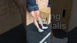 Thumbnail: How to fix shin splints (stop only doing toe raises)